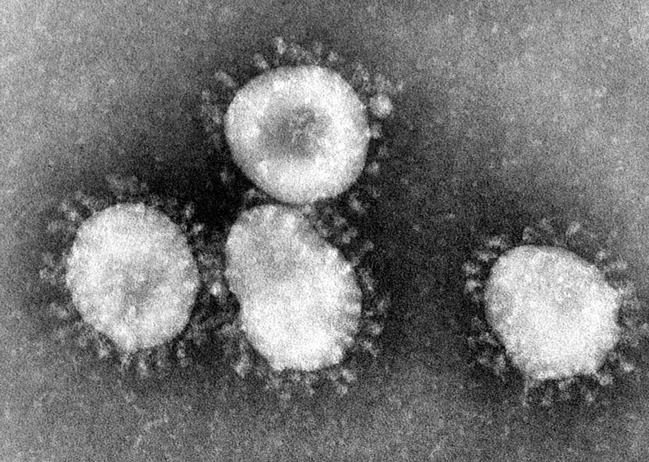 SARS virus particles (Wikipedia)